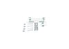 Accessory Kit, brake shoes -