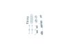 Accessory Kit, parking brake shoes -
