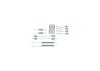 Accessory Kit, brake shoes -