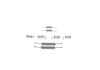 Accessory Kit, parking brake shoes -