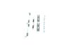 Accessory Kit, brake shoes -