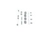 Accessory Kit, brake shoes -