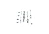 Accessory Kit, brake shoes -